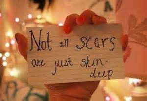 obt_one_tiny_lie_ten_ti